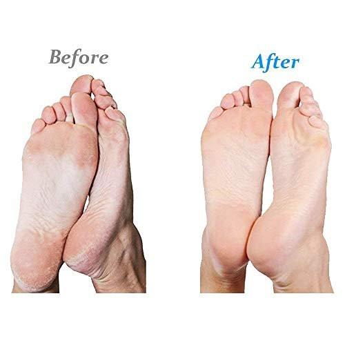 Emjoi Micro-Pedi Nachfüllwalzen (Extra Grob) – 4er-Pack