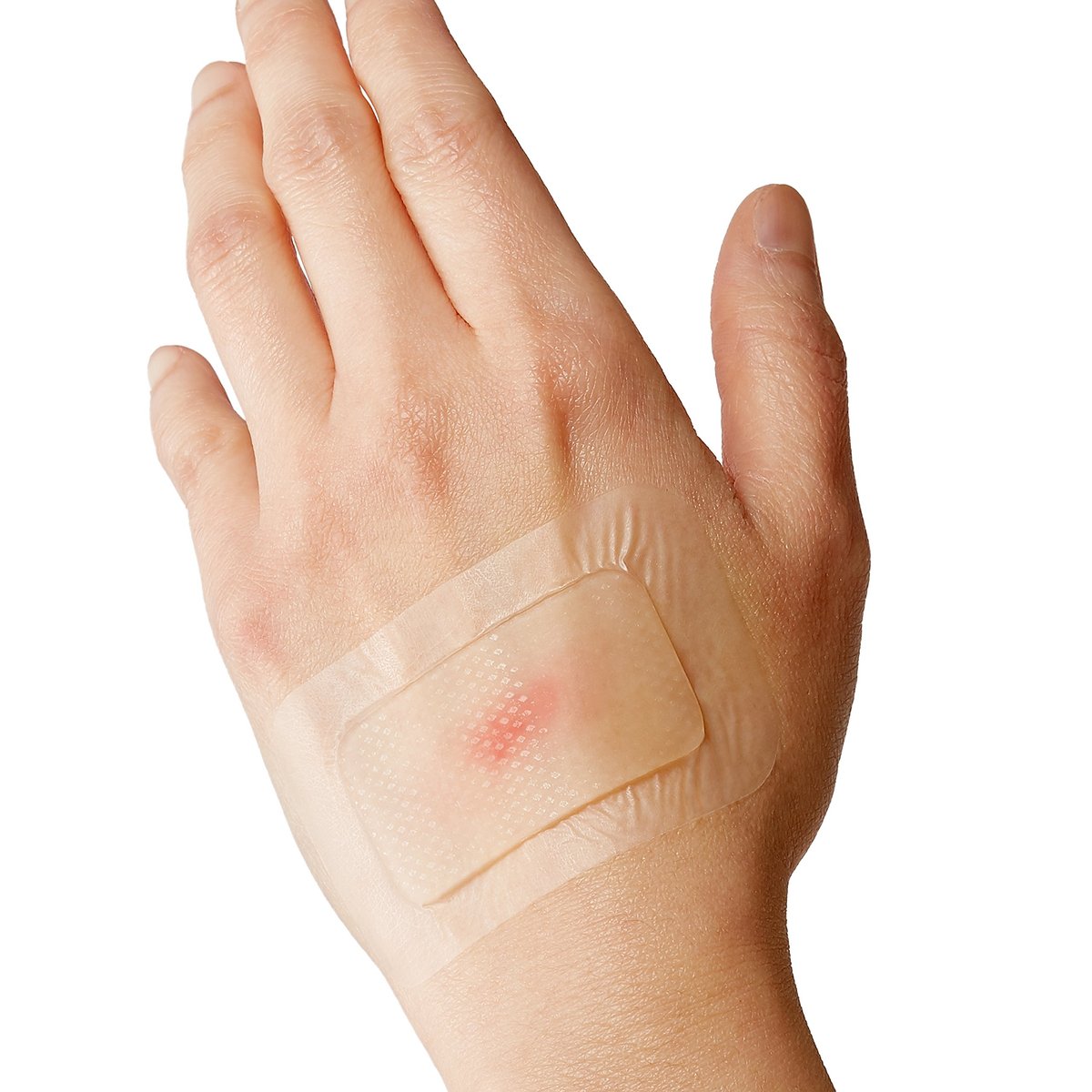 Curad Soothe & Cool Kühlende Brandwundenpflaster, sofortige Kühlung, verschiedene Größen, 8 Stück