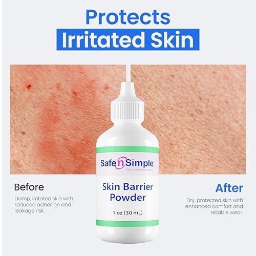 Safe n' Simple Stoma Hautschutzpuder - 28 g - Medizinischer Schutzpuder für Stoma - Haftpuder für Stomaversorgung