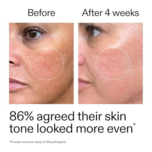 The INKEY List Starter Dual Retinol Serum – 0,5% Amisol Trio & 0,2% Symrelief, 30 ml – Sanfte Hauterneuerung, glättet feine Linien, Feuchtigkeit & Barriereschutz – Geeignet für empfindliche Haut