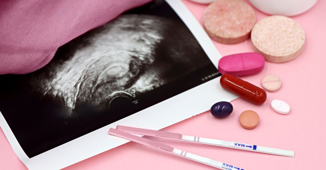 Prenatal Vitamins Buying Guide: Mehrere Flaschen mit Schwangerschaftsvitaminen auf einem Tisch, darunter Folsäure- und DHA-Präparate.