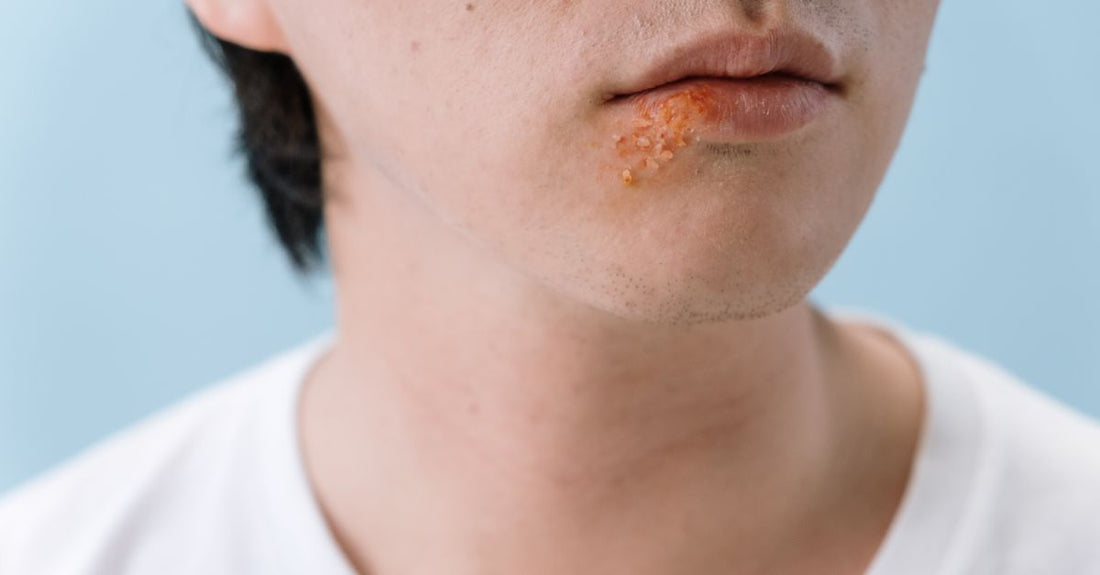 Yeast Infection Treatments Buying Guide: Eine Auswahl an Produkten zur Behandlung von Hefepilzinfektionen, darunter Tabletten und Kapseln, auf einem hellen Hintergrund.