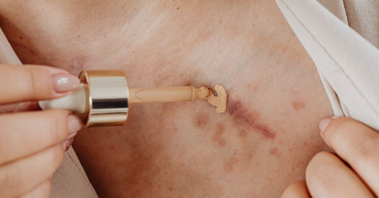 Narben & Wundpflege Buying Guide: Silikongel-Tube und Pflegeprodukte auf hellem Hintergrund