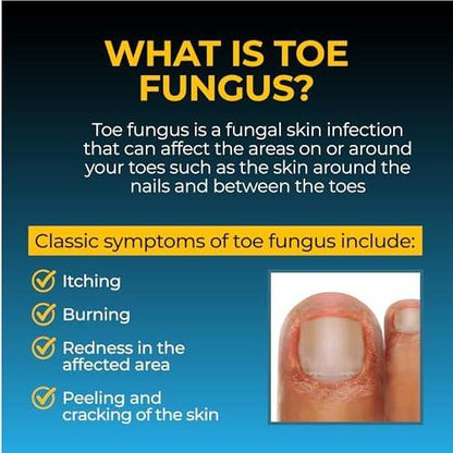 Fungi-Nail Anti-Pilz Flüssigkeit, 30 ml, gegen Nagelpilz und Fußpilz mit Tolnaftat, klinisch erprobt