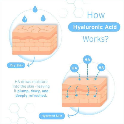 Hyalogic Episilk Pure HA Gesichtsserum – Feuchtigkeitsspendendes Hyaluronsäure-Serum für weiche, hydratisierte Haut – 30 ml