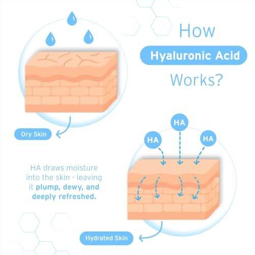 Hyalogic Episilk Pure HA Gesichtsserum – Feuchtigkeitsspendendes Hyaluronsäure-Serum für weiche, hydratisierte Haut – 30 ml