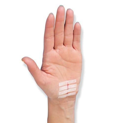 Nexcare Steri-Strip Wundverschluss, atmungsaktive Streifen für kleinen Wunden, ideal nach Nähten oder Klammern - 30 Wundverschlüsse