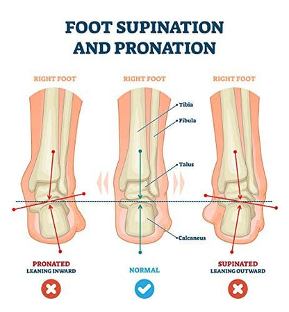 pedag Correct Fersenkeil | Medialer & Lateraler Keil für Pronation & Supination | Knickfuß & O-Bein Schmerzen | Hergestellt in Deutschland | Extra Large (Herren 11L bis 13)