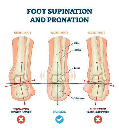 pedag Correct Fersenkeil | Medialer & Lateraler Keil für Pronation & Supination | Knickfuß & O-Bein Schmerzen | Hergestellt in Deutschland | Extra Large (Herren 11L bis 13)