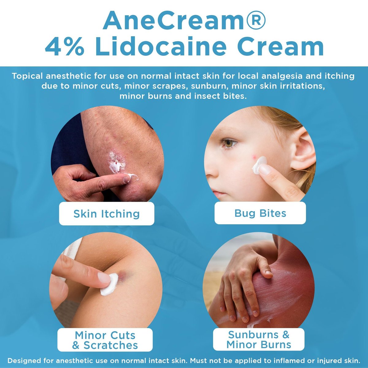 AneCream 4% Lidocain Creme – Topische Betäubungscreme gegen Juckreiz, kleine Schnitte, Schürfwunden, Insektenstiche und leichten Sonnenbrand (0,5 oz / 15 g)