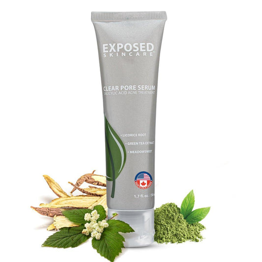 Exposed Skin Care Clear Pore Serum mit 1% Salicylsäure für empfindliche und fettige Haut – Sanfte Reinigung von Mitessern, Verkleinerung der Poren und Reduzierung von überschüssigem Öl – natürlich, ungiftig und tierversuchsfrei