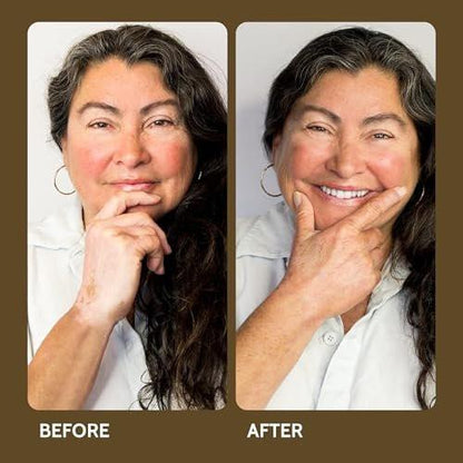 Fake Bake Vitiligo Vanquish Kosmetik-Camouflage-Kit – Langanhaltende flüssige Concealer für natürliche Farbanpassung, kaschiert Hautdepigmentierung für Frauen & Männer – Abdeckung hält tagelang