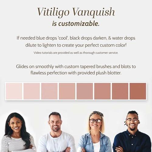 Fake Bake Vitiligo Vanquish Kosmetik-Camouflage-Kit – Langanhaltende flüssige Concealer für natürliche Farbanpassung, kaschiert Hautdepigmentierung für Frauen & Männer – Abdeckung hält tagelang