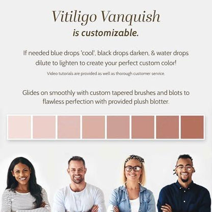 Fake Bake Vitiligo Vanquish Kosmetik-Camouflage-Kit – Langanhaltende flüssige Concealer für natürliche Farbanpassung, kaschiert Hautdepigmentierung für Frauen & Männer – Abdeckung hält tagelang