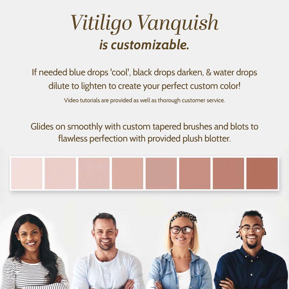 Fake Bake Vitiligo Vanquish Kosmetik-Camouflage-Kit – Langanhaltende flüssige Concealer für natürliche Farbanpassung, kaschiert Hautdepigmentierung für Frauen & Männer – Abdeckung hält tagelang