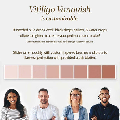 Fake Bake Vitiligo Vanquish Kosmetik-Camouflage-Kit – Langanhaltende flüssige Concealer für natürliche Farbanpassung, kaschiert Hautdepigmentierung für Frauen & Männer – Abdeckung hält tagelang