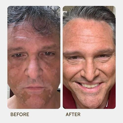 Fake Bake Vitiligo Vanquish Kosmetik-Camouflage-Kit – Langanhaltende flüssige Concealer für natürliche Farbanpassung, kaschiert Hautdepigmentierung für Frauen & Männer – Abdeckung hält tagelang