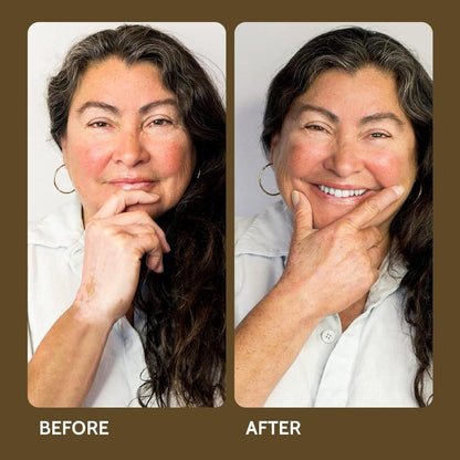 Fake Bake Vitiligo Vanquish Kosmetik-Camouflage-Kit – Langanhaltende flüssige Concealer für natürliche Farbanpassung, kaschiert Hautdepigmentierung für Frauen & Männer – Abdeckung hält tagelang