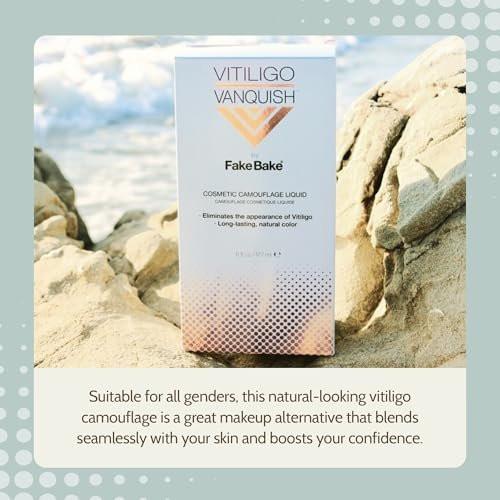 Fake Bake Vitiligo Vanquish Kosmetik-Camouflage-Kit – Langanhaltende flüssige Concealer für natürliche Farbanpassung, kaschiert Hautdepigmentierung für Frauen & Männer – Abdeckung hält tagelang