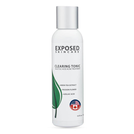 Exposed Skin Care Klärendes Gesichtswasser mit 1% Salicylsäure und Hamamelis – Tägliches Toner für Teenager und Erwachsene mit Akne, Mitessern und fettiger Haut – Natürlich, ungiftig und tierversuchsfrei