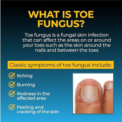 Fungi Nail Anti-Fungale Salbe 0,7 Fl Oz – Tötet Pilze, die zu Fußpilz führen können, mit Tolnaftat – Zehennagelpilzbehandlung – klinisch erwiesen zur Heilung von Infektionen – natürliche Farbe