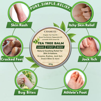 Chamuel Teebaumöl-Balsam – Natürliche Linderung bei Juckreiz, Hautausschlag, Fußpilz & Insektenstichen – Für empfindliche Haut – 60 g