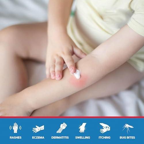 MED Pride Hydrocortison-Creme 1%, 28 g – Maximale Stärke gegen Juckreiz & Entzündungen bei Ekzemen, Dermatitis, Hautausschlägen, Giftefeu, Rötungen & leichten Hautreizungen