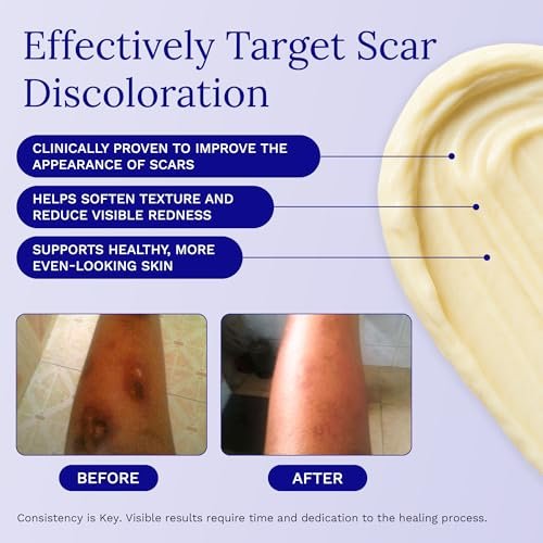 Rejuvaskin Scar Esthetique Narbencreme mit Silikon – Reduziert das Erscheinungsbild von Operationsnarben, Verbrennungen, Dehnungsstreifen, Keloiden & Aknenarben, 10 ml