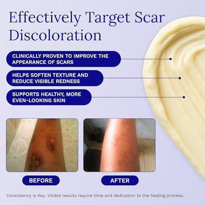 Rejuvaskin Scar Esthetique Narbencreme mit Silikon – Reduziert das Erscheinungsbild von Operationsnarben, Verbrennungen, Dehnungsstreifen, Keloiden & Aknenarben, 10 ml