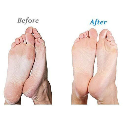 Emjoi Micro-Pedi Nachfüllwalzen (Extra Grob) – 4er-Pack