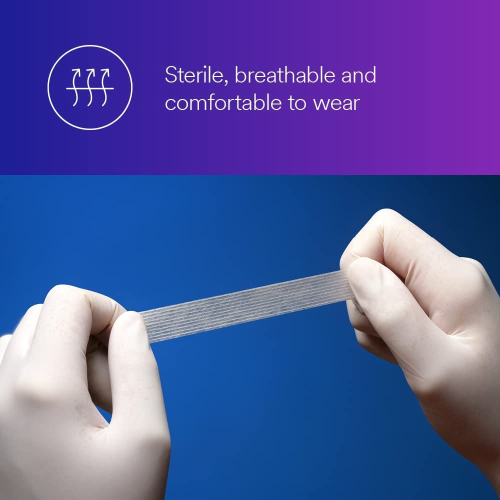 3M™ Steri-Strip™ Verstärkte Wundverschlussstreifen, R1546, 1/4 Zoll x 4 Zoll (6 mm x 100 mm), 50 Beutel/Karton, 4 Kartons/Kiste
