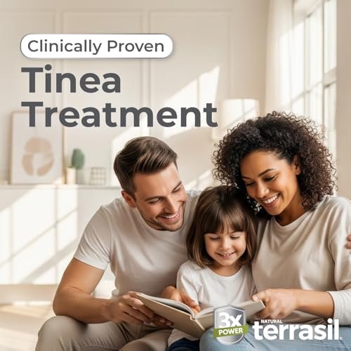 Terrasil Tinea Versicolor Behandlung Creme Max Stärke – Antimykotische Creme mit klinisch geprüftem 1% Clotrimazol gegen Pilzinfektionen, Ringelflechte und Juckreiz (0,5 Unzen)