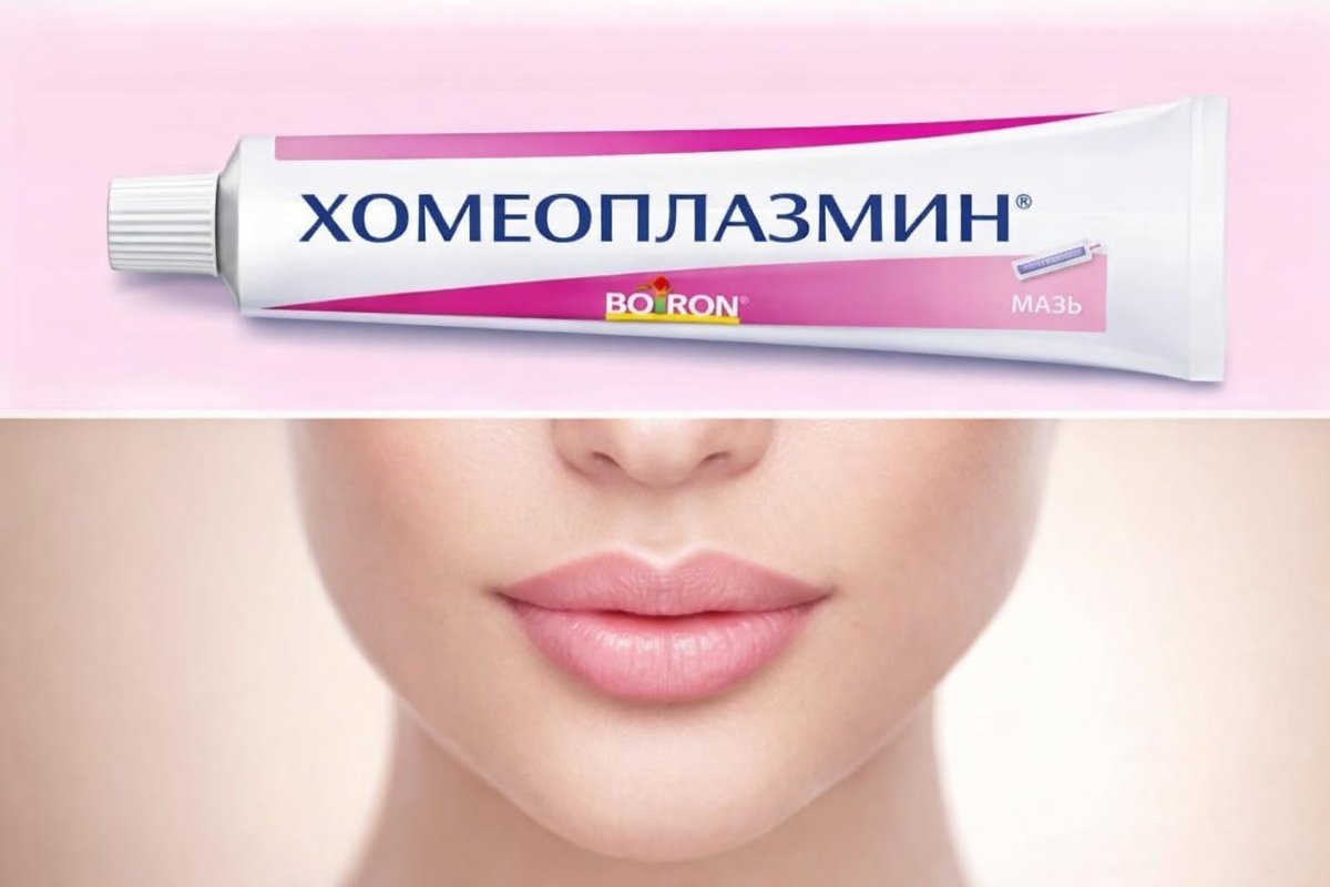 Homeoplasmine XL 40g – Die Original Zaubercreme für trockene Haut, Irritationen und weiche Lippen [Französische Originalverpackung]