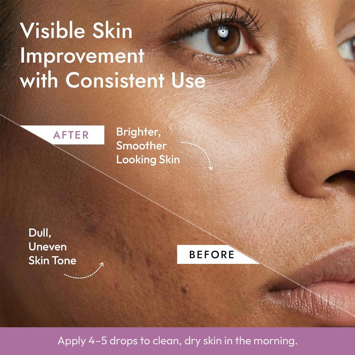 DERMAdoctor Vitamin C Serum 20% mit Vitamin E, Ferulasäure, Ascorbinsäure – Konzentriertes Anti-Aging Gesichtsserum für Feuchtigkeit & Verfärbungen, 30 ml