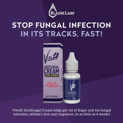 VITÉ20 V20 Vite 20 Antifungal Creme – Fuß- und Nagelpilzbehandlung für Hände und Füße