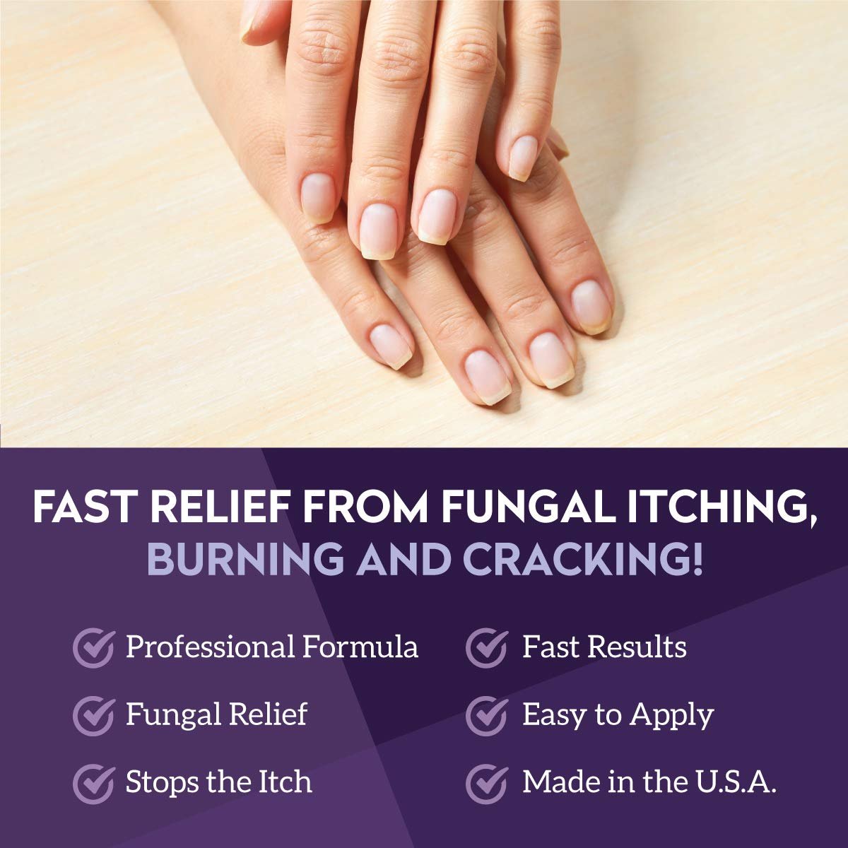 VITÉ20 V20 Vite 20 Antifungal Creme – Fuß- und Nagelpilzbehandlung für Hände und Füße