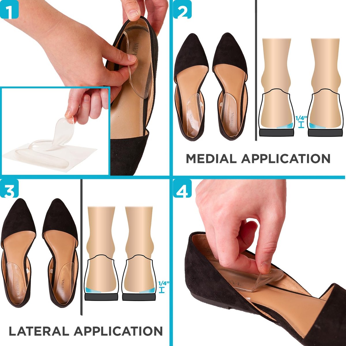 BraceAbility Mediale & Laterale Fersenkeil Silikon Einlegesohlen (Paar) - Korrektur von Supination & Pronation, selbstklebende Schuheinlagen für Fußausrichtung, Knieschmerzen, O-Beine, Arthrose