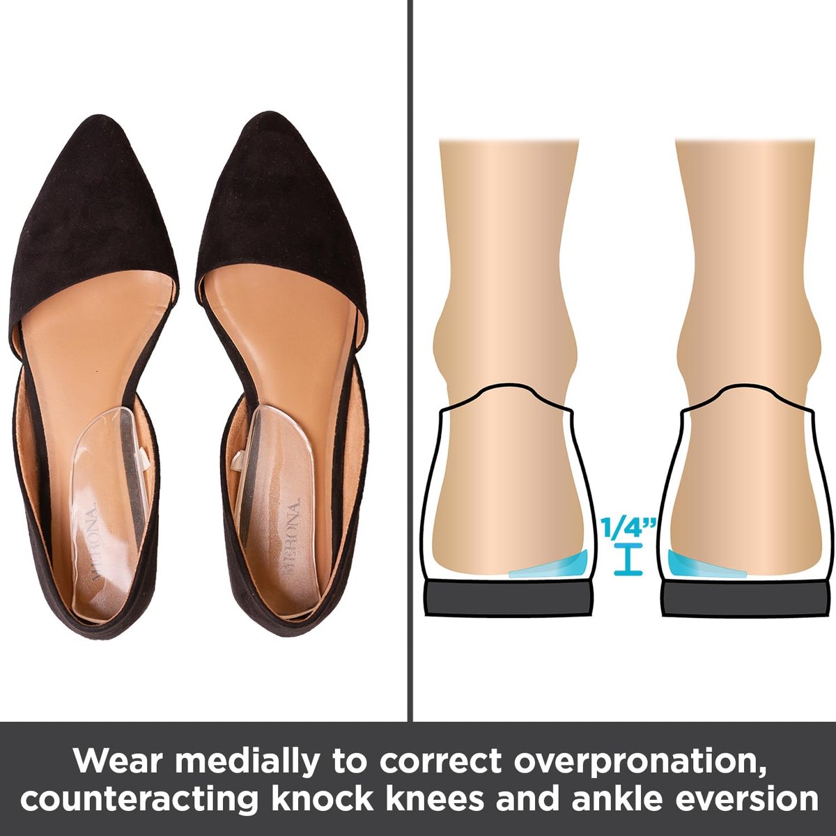 BraceAbility Mediale & Laterale Fersenkeil Silikon Einlegesohlen (Paar) - Korrektur von Supination & Pronation, selbstklebende Schuheinlagen für Fußausrichtung, Knieschmerzen, O-Beine, Arthrose