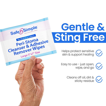 Safe n' Simple Kleberentferner-Tücher für die Haut – 50 einzeln verpackte Tücher (12,7 x 17,8 cm) – Alkoholfrei, sanft zu empfindlicher Haut – Stoma-Kleberentferner ohne Brennen