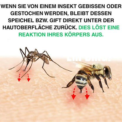 Bug Bite Thing Saugwerkzeug – Insektenstiche & Bienen-/Wespenstiche lindern, natürlich, chemiefrei, Weiß