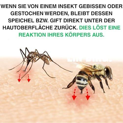 Bug Bite Thing Saugwerkzeug – Insektenstiche & Bienen-/Wespenstiche lindern, natürlich, chemiefrei, Weiß