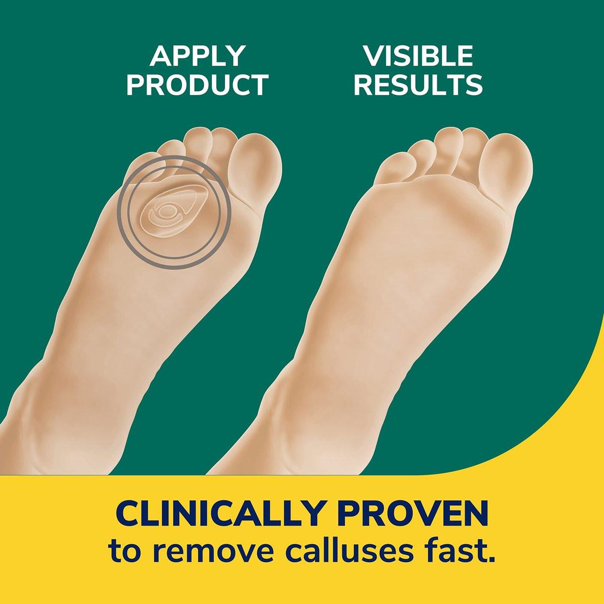 Dr. Scholl's Hühneraugen-Entferner Seal & Heal Pflaster mit Hydrogel-Technologie, 4 Stück