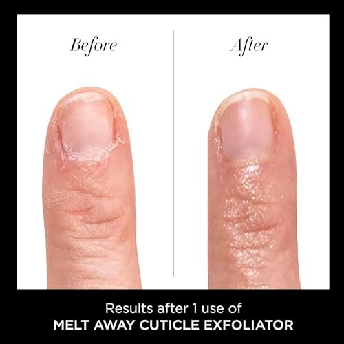 butter LONDON Nagelhautentferner Flüssigkeit, Melt Away – Nagelhautöl-Peeling & Weichmacher, entfernt sanft trockene, überwachsene Nagelhaut für gesund aussehende Nägel – schnell wirkend & schmerzfrei – 0,4 Fl Oz