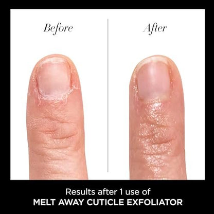 butter LONDON Nagelhautentferner Flüssigkeit, Melt Away – Nagelhautöl-Peeling & Weichmacher, entfernt sanft trockene, überwachsene Nagelhaut für gesund aussehende Nägel – schnell wirkend & schmerzfrei – 0,4 Fl Oz