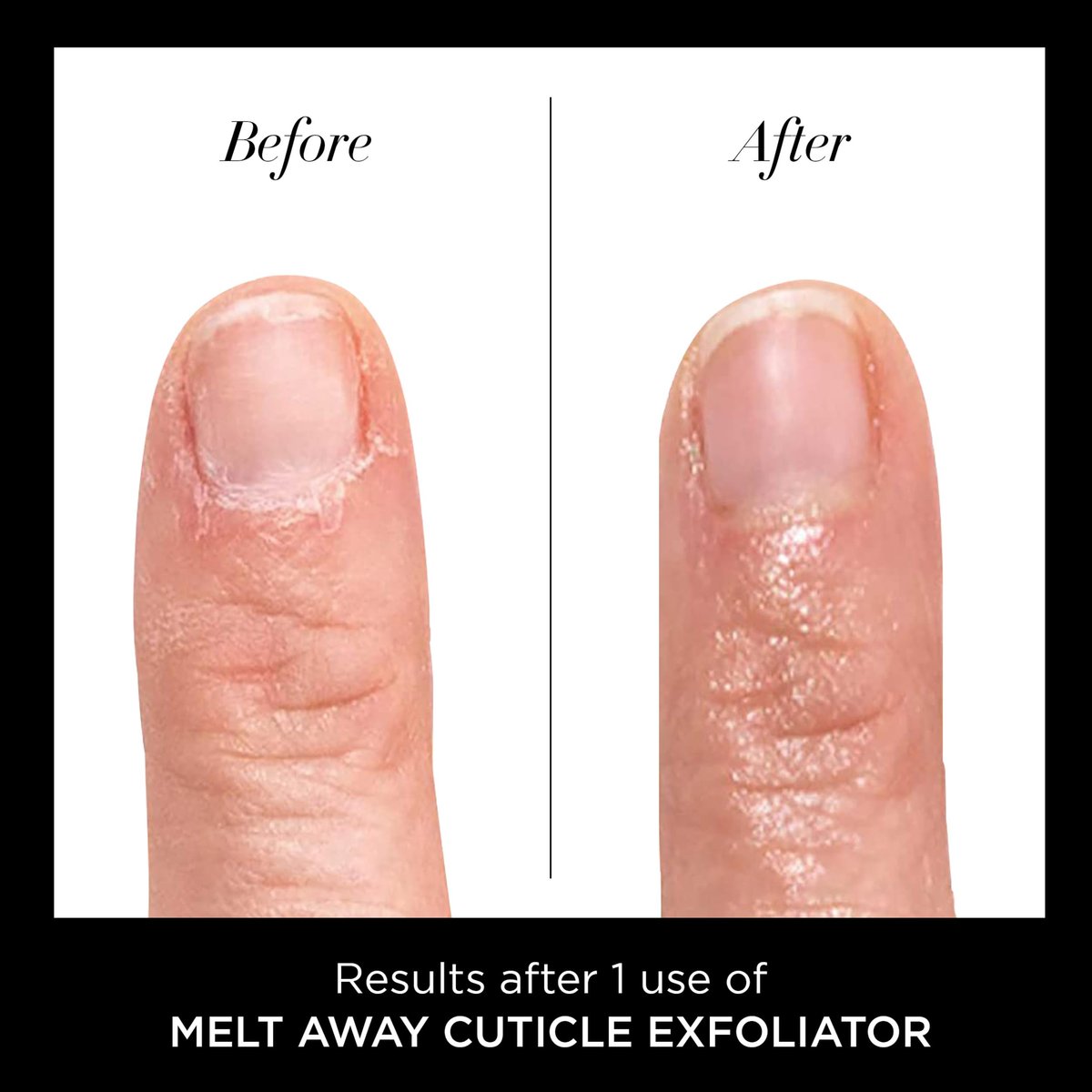 butter LONDON Nagelhautentferner Flüssigkeit, Melt Away – Nagelhautöl-Peeling & Weichmacher, entfernt sanft trockene, überwachsene Nagelhaut für gesund aussehende Nägel – schnell wirkend & schmerzfrei – 0,4 Fl Oz