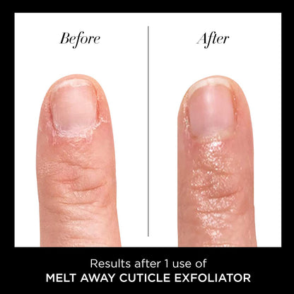 butter LONDON Nagelhautentferner Flüssigkeit, Melt Away – Nagelhautöl-Peeling & Weichmacher, entfernt sanft trockene, überwachsene Nagelhaut für gesund aussehende Nägel – schnell wirkend & schmerzfrei – 0,4 Fl Oz
