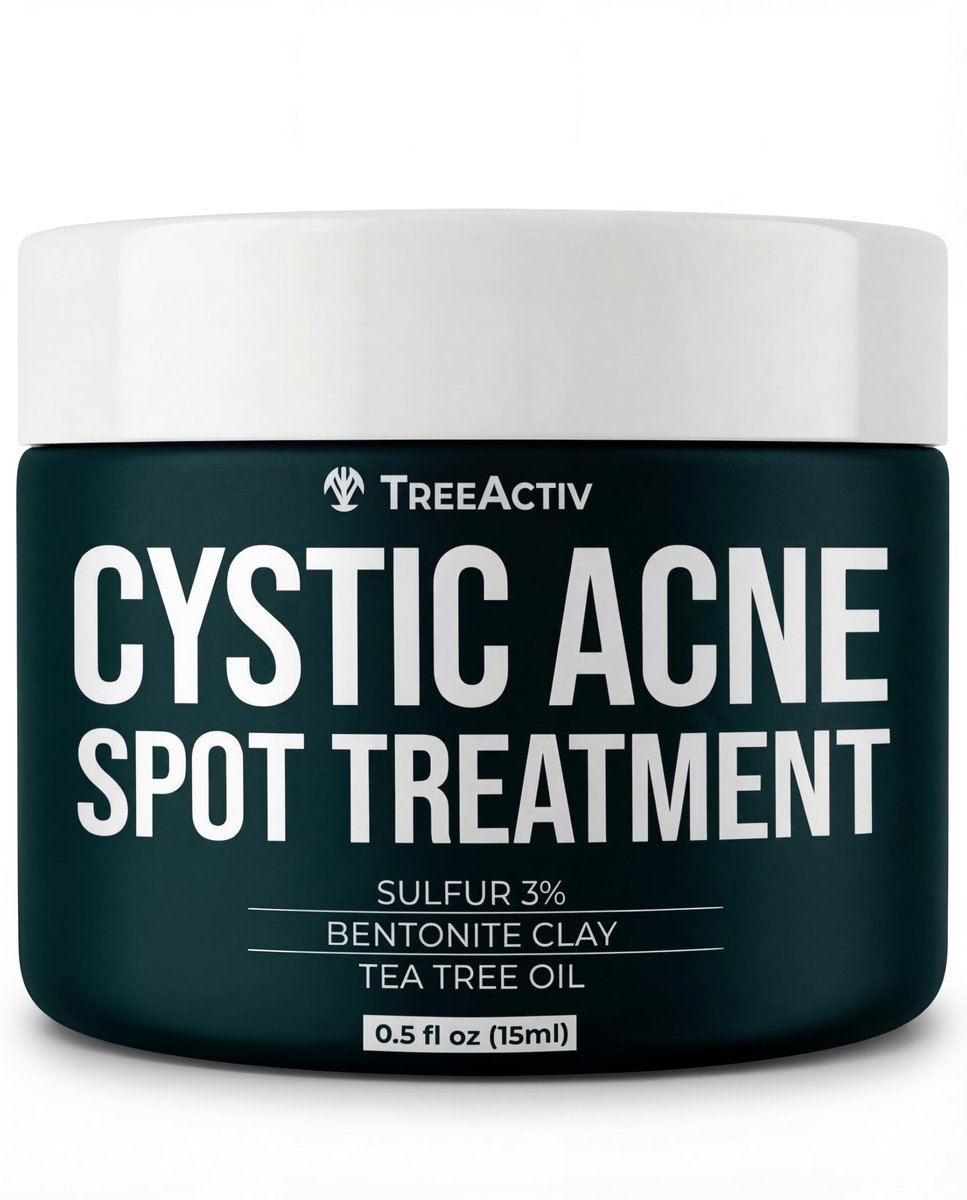 TreeActiv Cystic Akne Spot Treatment Paste mit Schwefel, Bentonit-Tonerde und Teebaumöl – Tiefenwirksame Behandlung für Pickel, 20-minütige oder Über-Nacht-Anwendung, geeignet für Gesicht und Körper, 15 ml