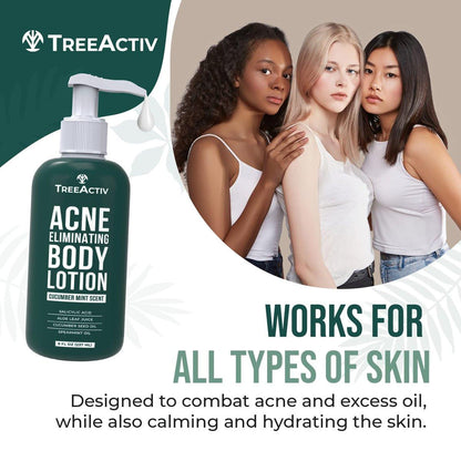 TreeActiv Akne-Bekämpfende Körperlotion 236 ml | Klärt Körper-, Rücken-, Po- und Schulterakne | Anti-Akne-Feuchtigkeitscreme | Verhindert zukünftige Ausbrüche | Duft nach Gurke und Minze