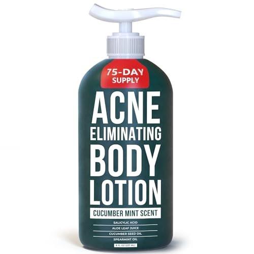 TreeActiv Akne-Bekämpfende Körperlotion 236 ml | Klärt Körper-, Rücken-, Po- und Schulterakne | Anti-Akne-Feuchtigkeitscreme | Verhindert zukünftige Ausbrüche | Duft nach Gurke und Minze
