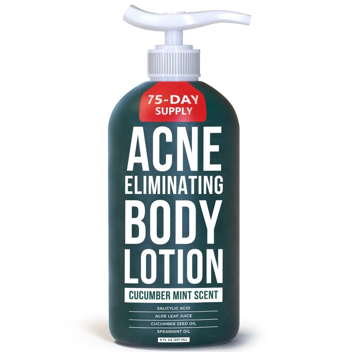 TreeActiv Akne-Bekämpfende Körperlotion 236 ml | Klärt Körper-, Rücken-, Po- und Schulterakne | Anti-Akne-Feuchtigkeitscreme | Verhindert zukünftige Ausbrüche | Duft nach Gurke und Minze